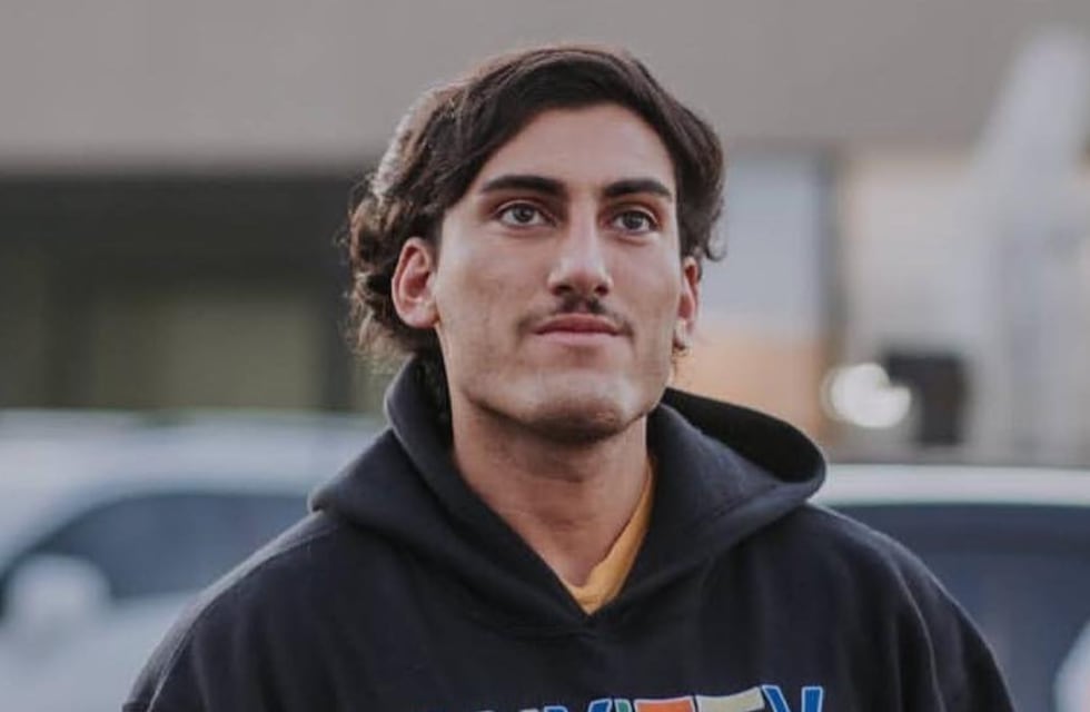 Tras la viralización del video sexual, Tomás Holder se hizo un retoque estético