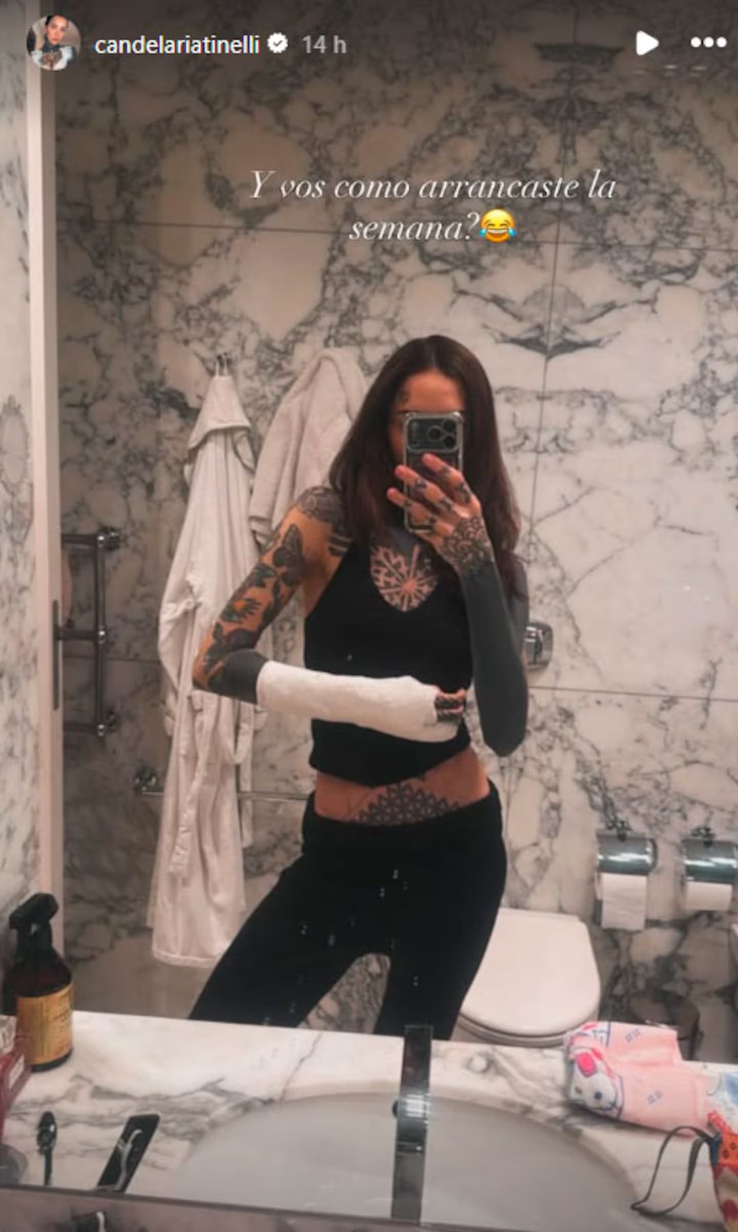 El accidente de Cande Tinelli por el que debió ser operada