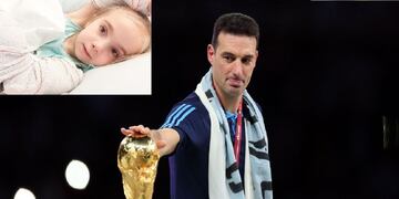 Scaloni se sumó a la campaña para ayudar a la pequeña mendocina, Juanita, tras la operación de sus manitos en Barcelona.