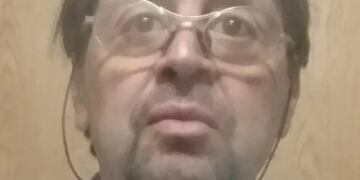 Él es Miguel Ángel Cabello, quien agredió al traumatólogo Daniel Luque con ácido por presunta mala praxis.