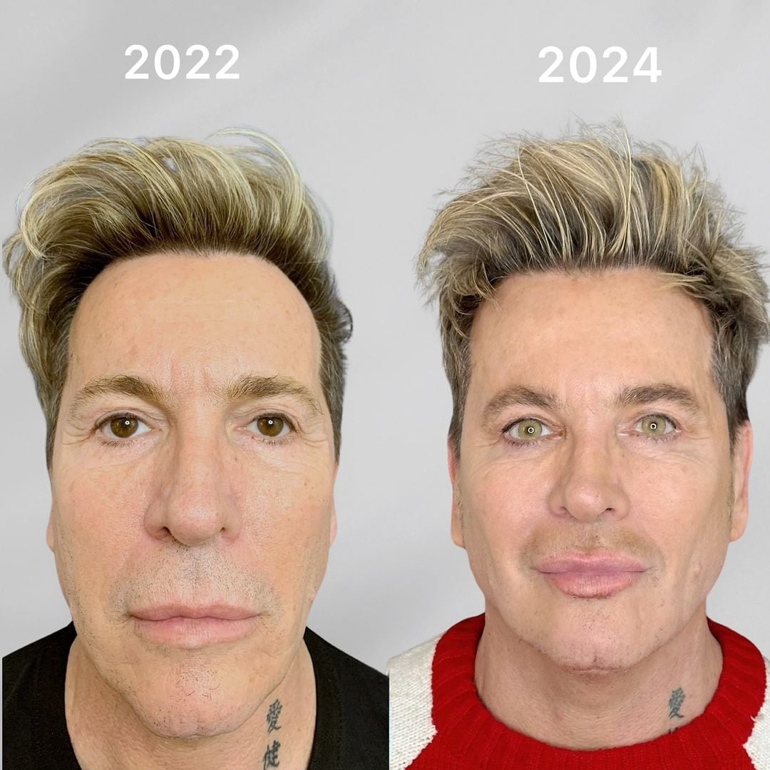 El impresionante cambio de Guido Süller.