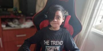 Juan Pablo Gaetán el niño de Arroyito que padece Piel de Cristal