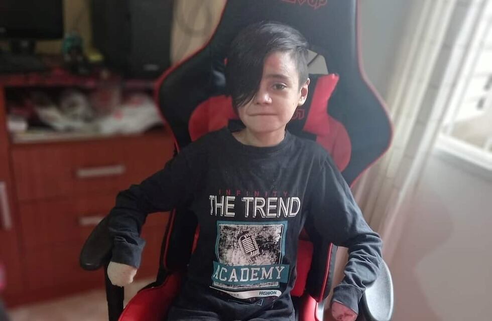 Arroyito: Juampi el niño con piel de cristal, se recupera luego de unos estudios que le han realizado