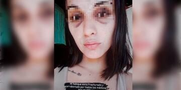 La víctima tiene 24 años.