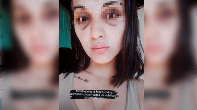 La víctima tiene 24 años.