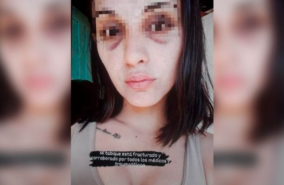 Fuerte testimonio de la joven agredida por el cantante de Labriegos: “Me encerró en el baño y me pegó”