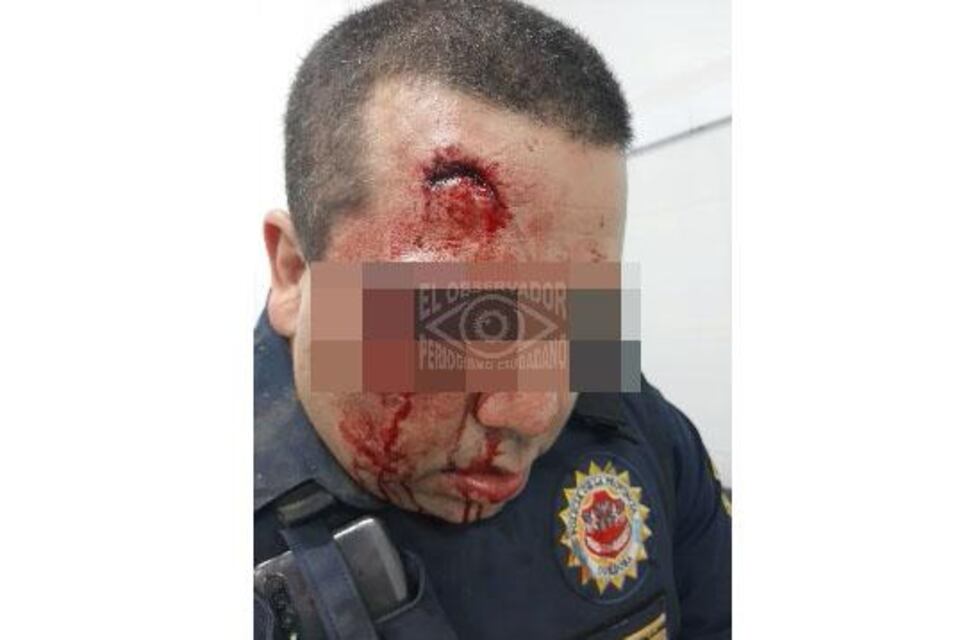 Fiesta clandestina, un detenido, un policía golpeado y un móvil destruído