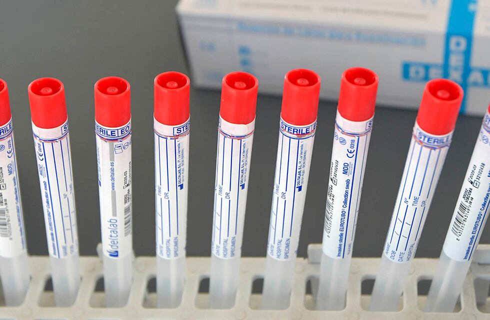 Coronavirus: 2 casos este lunes en San Luis