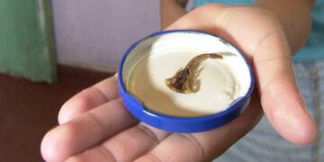 El bebé fue picado por un alacrán en su casa ubicada en camino a Chacra de la Merced. (Sergio Cejas/Archivo).