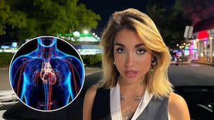 Qué significa un “shock hipovolémico”, el problema de salud que sufrió María Becerra y cuáles son sus consecuencias