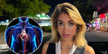 Qué significa un “shock hipovolémico”, el problema de salud que sufrió María Becerra y cuáles son sus consecuencias