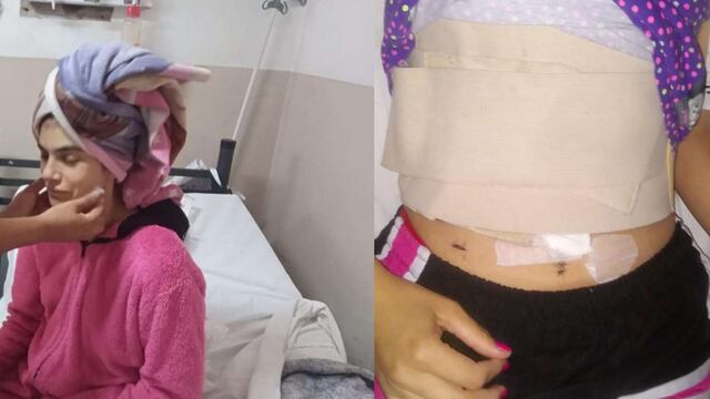 Tras ser apuñalada por su pareja, se recuperó rápidamente.