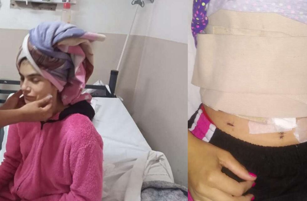Sobrevivió a un intento de femicidio y pide ayuda para volver a Corrientes