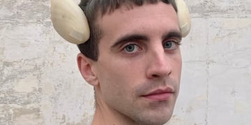 Se implantó alas en la cabeza