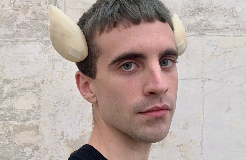 Un hombre se realizó un implante de dos aletas en la cabeza: “No me considero 100% humano”