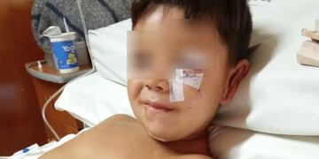 Pequeño mordido por un dogo en Arroyo Pareja