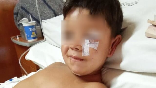 Pequeño mordido por un dogo en Arroyo Pareja