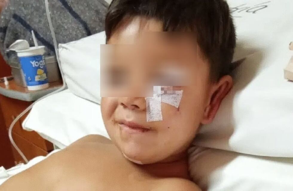 El pequeño mordido por un dogo en Arroyo Pareja fue dado de alta