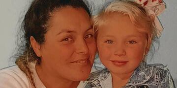 Rifa para Guillermina que perdió un 97% de la visión