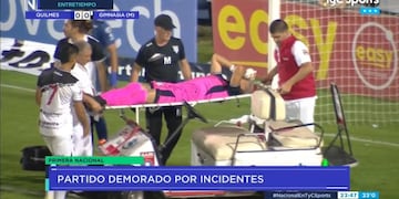 Brian Olivera, exarquero de Instituto, que recibió el impacto de un proyectil en el partido entre Quilmes y Gimnasia de Mendoza. (Captura de TV)