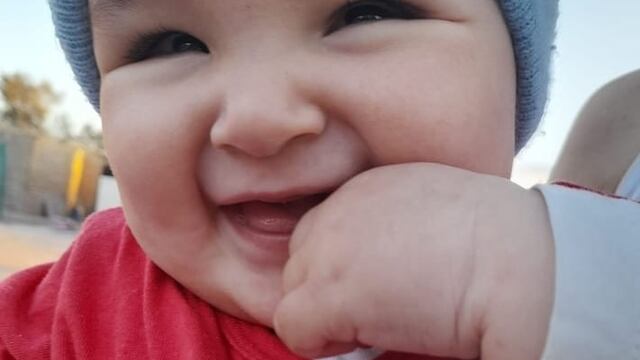 Benicio, el bebé sanjuanino que necesita someterse a un costoso tratamiento en Buenos Aires para poder recuperar su visión.