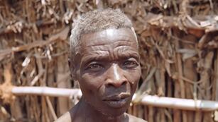 Increíble caso en África.