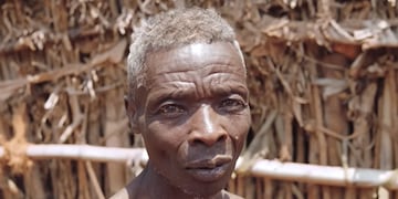 Increíble caso en África.