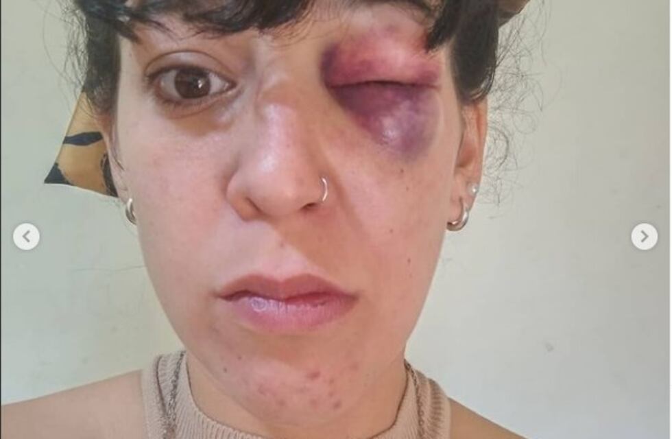 Violencia de género en San Luis: una joven denunció que fue golpeada por su pareja