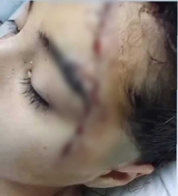 Ocurrió en San Cristóbal.