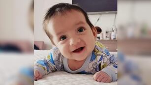 Él es Camilo, el bebé salteño que padece  craneosinostosis lambdoidea y necesita una intervención quirúrgica.