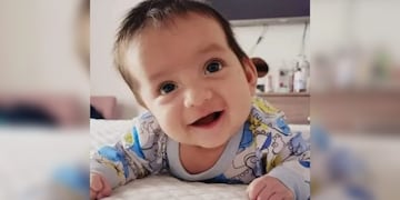 Él es Camilo, el bebé salteño que padece craneosinostosis lambdoidea y necesita una intervención quirúrgica.