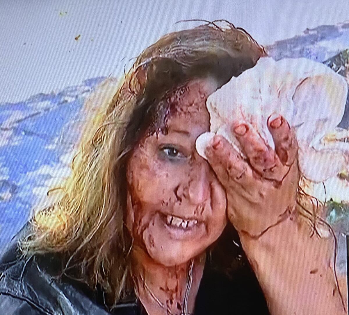 Mujer con el rostro destrozado por culatazos de delincuentes (Captura imagen TV)