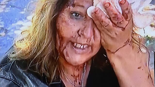 Mujer con el rostro destrozado por culatazos de delincuentes (Captura imagen TV)