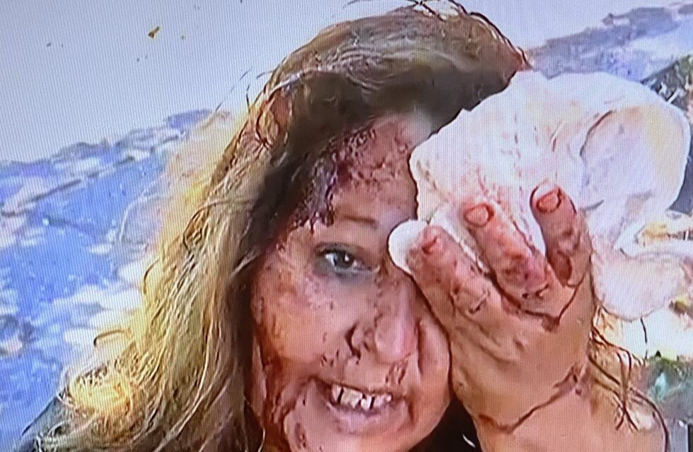 Le destrozaron la cara a culatazos a una mujer para robarle la moto