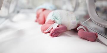 Bebé en neonatología. Imagen ilustrativa