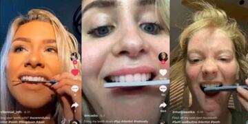Moda de TikTok que puede arruinar los dientes