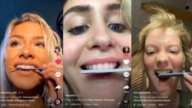 Moda de TikTok que puede arruinar los dientes