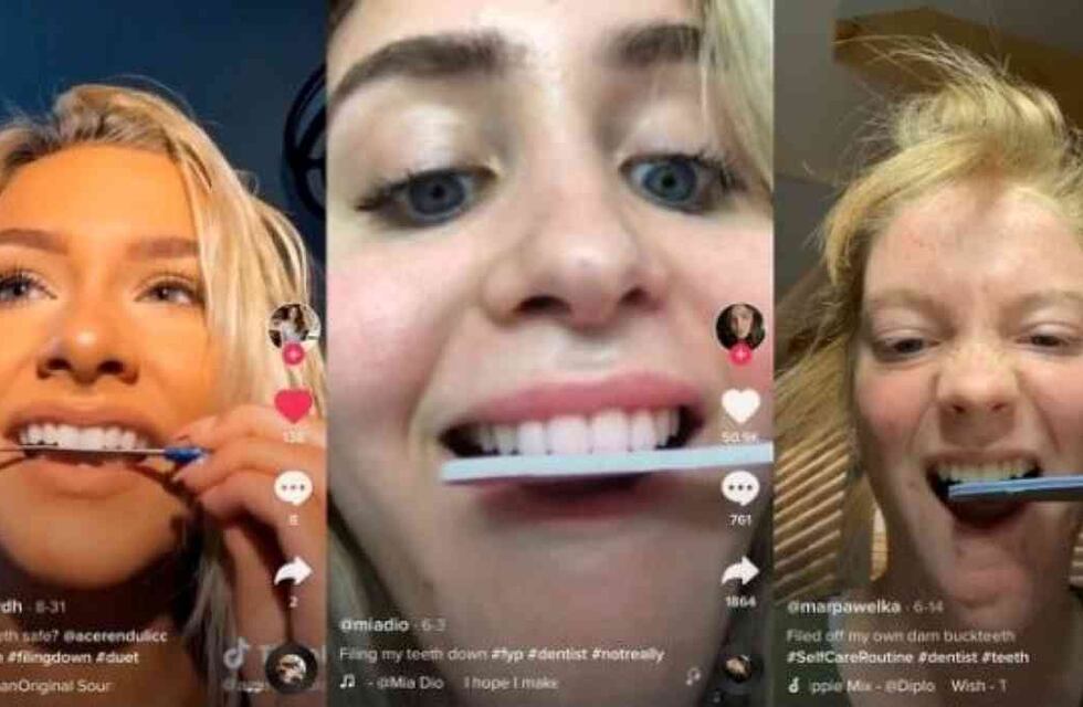 Un nuevo reto viral de Tik Tok puede arruinar los dientes