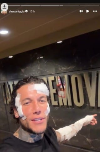 Alex Caniggia se borró los tatuajes de la cara y mostró el resultado: “Es de barat”