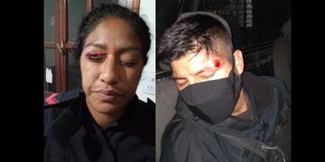 Dos de los cinco policías que resultaron heridos y lesionados durante un operativo de prevención en el barrio Campo Verde el 8 de marzo pasado.