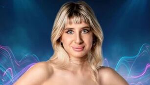 El tratamiento estético de Paloma de Gran Hermano 2024 para quitarse ácido hialurónico