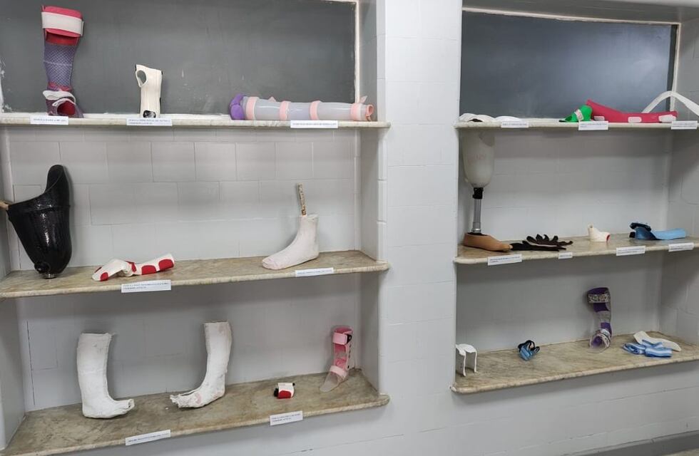 Una institución de Córdoba realiza prótesis gratuitas para pacientes sin obra social