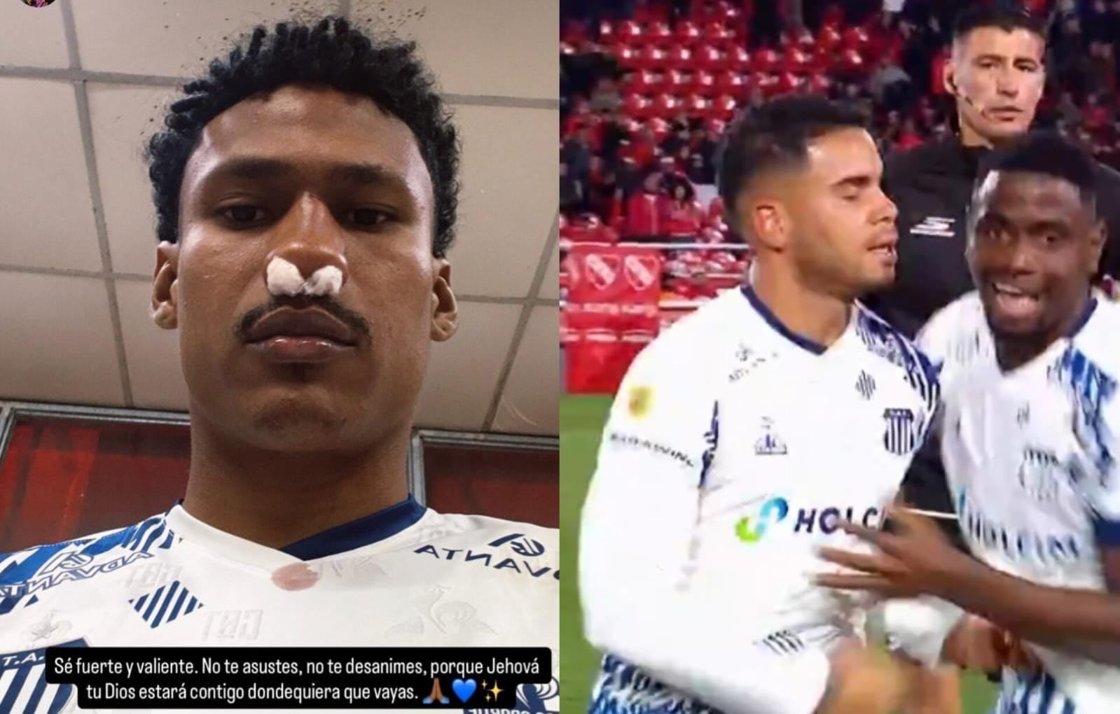 Rick se lesionó en el tabique nasal nuevamente, Navarro fue expulsado. Talleres recibe a Godoy Cruz este sábado a las 16.