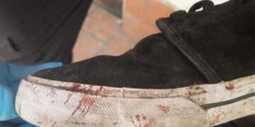 Crimen de Fernando Báez Sosa. La zapatilla sometida a una scopometría.