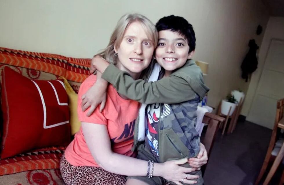 La lucha contra la discriminación de una mujer albina de San Juan: “No traemos mala suerte”