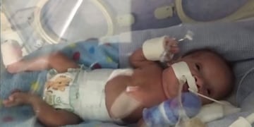 Josafat, el bebé prematuro que necesita de todos para tener su hogar en Fray Luis Beltrán.