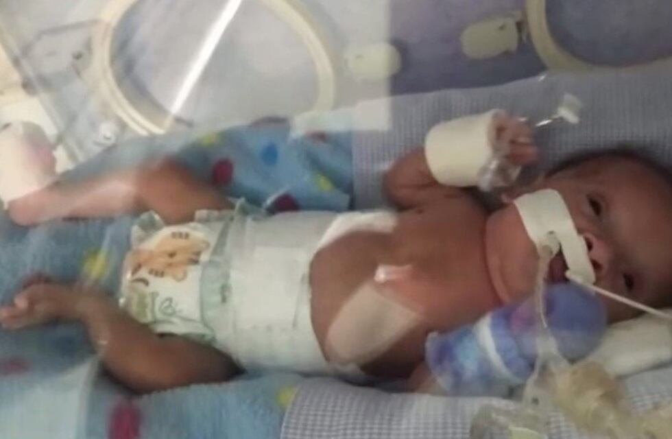 Pequeño santafesino pesó 476 gramos cuando nació: su familia necesita ayuda para acondicionar su casa para cuando reciba el alta