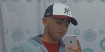 Facundo González tiene 19 años y necesita una cirugía costosa para reconstruir su rostro.