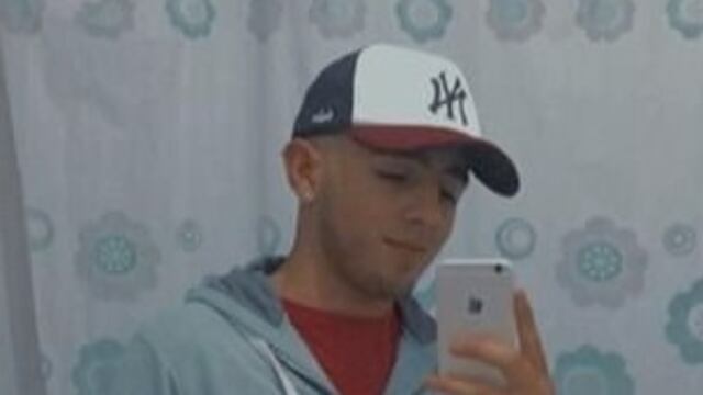 Facundo González tiene 19 años y necesita una cirugía costosa para reconstruir su rostro.