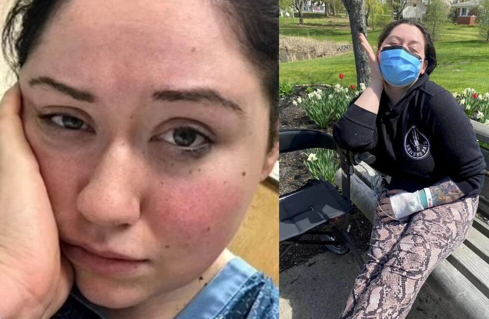 Una joven padece “alergia a la gravedad”, una enfermedad que le impide estar más de tres minutos de pie